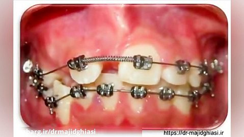 ارتودنسی دندان-دکترمجیدقیاسی -جراح ودندانپزشک