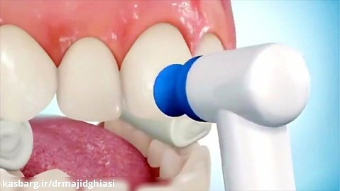 آموزش مراحل ارتودنسی دندان-دکترمجیدقیاسی جراح ودندانپزشک