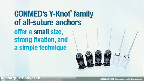 Y-Knot® All-Suture Anchor Family - CONMED Product Video