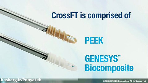 CrossFT™ Suture Anchor Family - CONMED Product Video