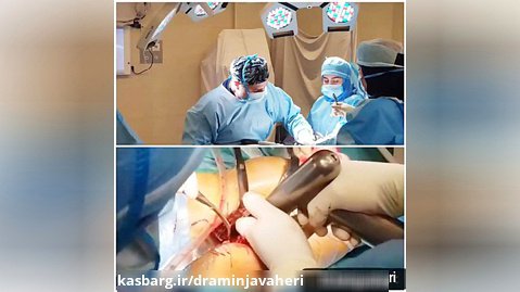 عمل جراحی تعویض مفصل لگن توسط دکتر علیرضا امین جواهری