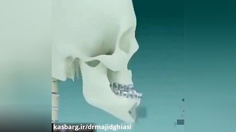 ارتودنسی دندان-دکترمجیدقیاسی دندانپزشک زیبایی مشهد
