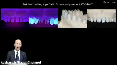 ترندهای جدید دندان پزشکی زیبایی