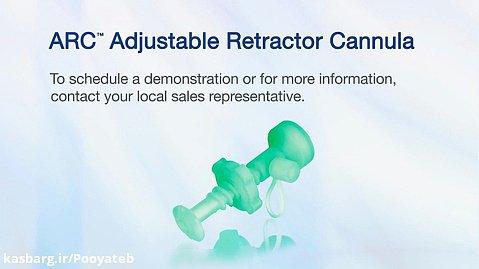 ARC Adjustable Retractor Cannula - Product Video