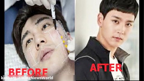 جراحی زیبایی بازیگران مرد کره ای شامل لی مین هو،چوی تای جوون،لی جونگ سوک و.. .