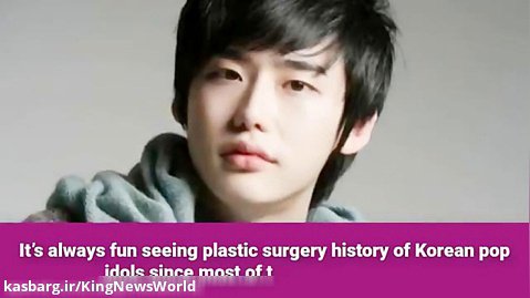 لی جونگ سوک قبل از عمل و بعد از عمل|تقدیم به طرفدارانش