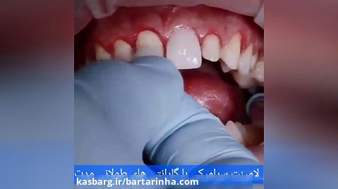 برترین ها - دکتر رضا نادری - دندانپزشک