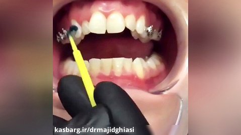 ارتودنسی دندان-دکترمجیدقیاسی-دندانپزشک زیبایی مشهد