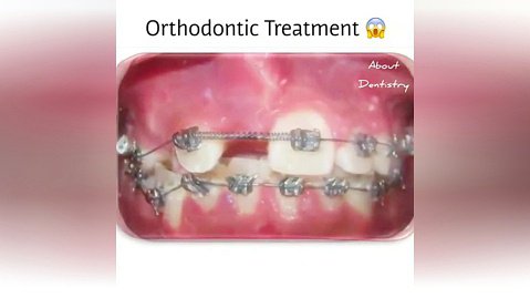 ارتودنسی دندان-دکترمجیدقیاسی دندانپزشک زیبایی مشهد