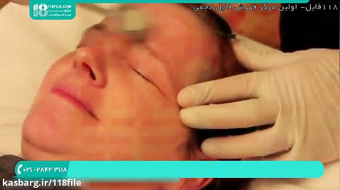 آموزش پاکسازی پوست | پاکسازی صورت ( نحوه درمان با درمارولر ) 28423118-021