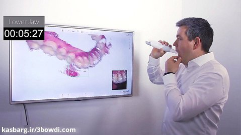 اسکنر فوق‌العاده سریع داخل دهان 3Shape برای دندانپزشکی و دندانسازی
