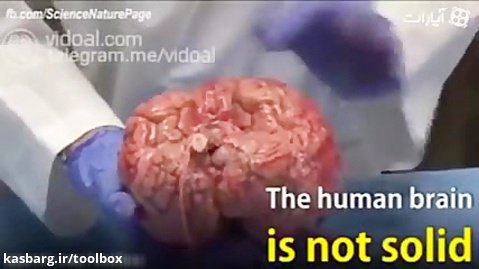 در این ویدیو از مغز واقعی انسان استفاده شده است