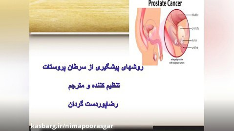 پیشگیری از سرطان پروستات
