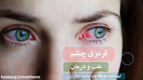 دلایل شایع قرمزی چشم و بهترین روش درمان آن