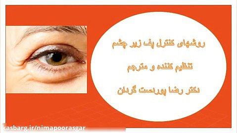 درمان پف زیر چشم